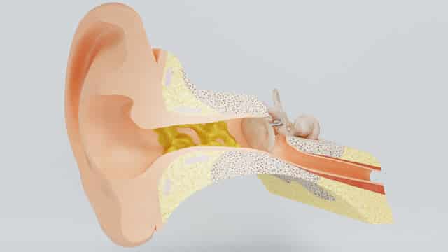 Earwax in Ear